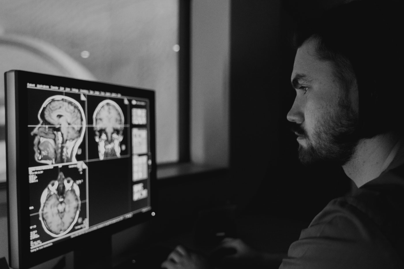 A radiologist reviewing multi-planar brain MRI on a DICOM viewer. Representative imaging workflow.
